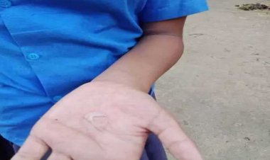 बच्चों को हाथें में डाला खौलता तेल, प्रधानपाठक सहित 4 बर्खास्त