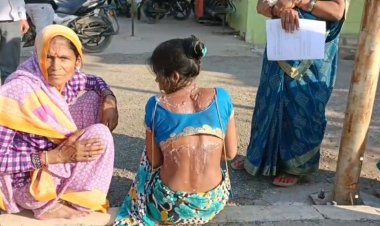 महिला पर डाला खौलता हुआ पानी, जेठ और जेठानी पर अपराध दर्ज