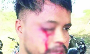 शराब कोच्चिया की दबंगई, सेल्समैन का फोड़ा आंख