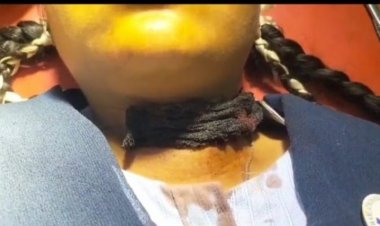 स्कूल से घर लौट रही छात्रा के गले पर ब्लेड से हमला