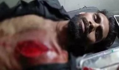 भिलाई में एक बार फिर चाकूबाजी, थर्माकोल कटर से जानलेवा हमला