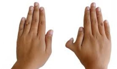 हाथ या पैर में 6 अंगुलियां होना अभिशाप या वरदान? समुद्र शास्त्र में लिखी है बड़ी बात