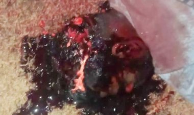 दुर्ग जिले में युवक की धारदार हथियार और पत्थर से कुचलकर हत्या