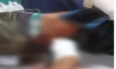 पारिवारिक विवाद में 2 सगे भाइयों ने मिलकर अपने फूफा के लड़के पर चाकू  से हमला कर घायल कर दिया