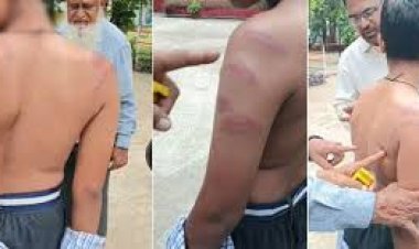 बिलासपुर में स्कूल टीचर ने बेरहमी से आठवीं कक्षा के छात्र की पिटाई कर दी