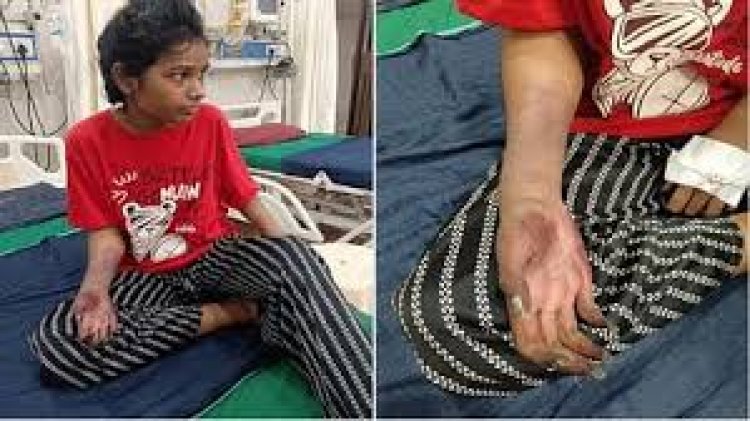 छत्तीसगढ़ के रायगढ़ में मेडिकल कॉलेज की लापरवाही से एक युवती के हाथ काटने तक नौबत आ गई