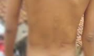 छत्तीसगढ़ के बिलासपुर में डायल 112 की टीम ने युवक की बेरहमी से पिटाई कर दी