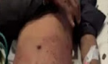 बीती रात खुर्सीपार में एक छोटे से विवाद ने हिंसक रूप लिया,तलवार और कटर से हमला, चार घायल, एक की हालत  गंभीर