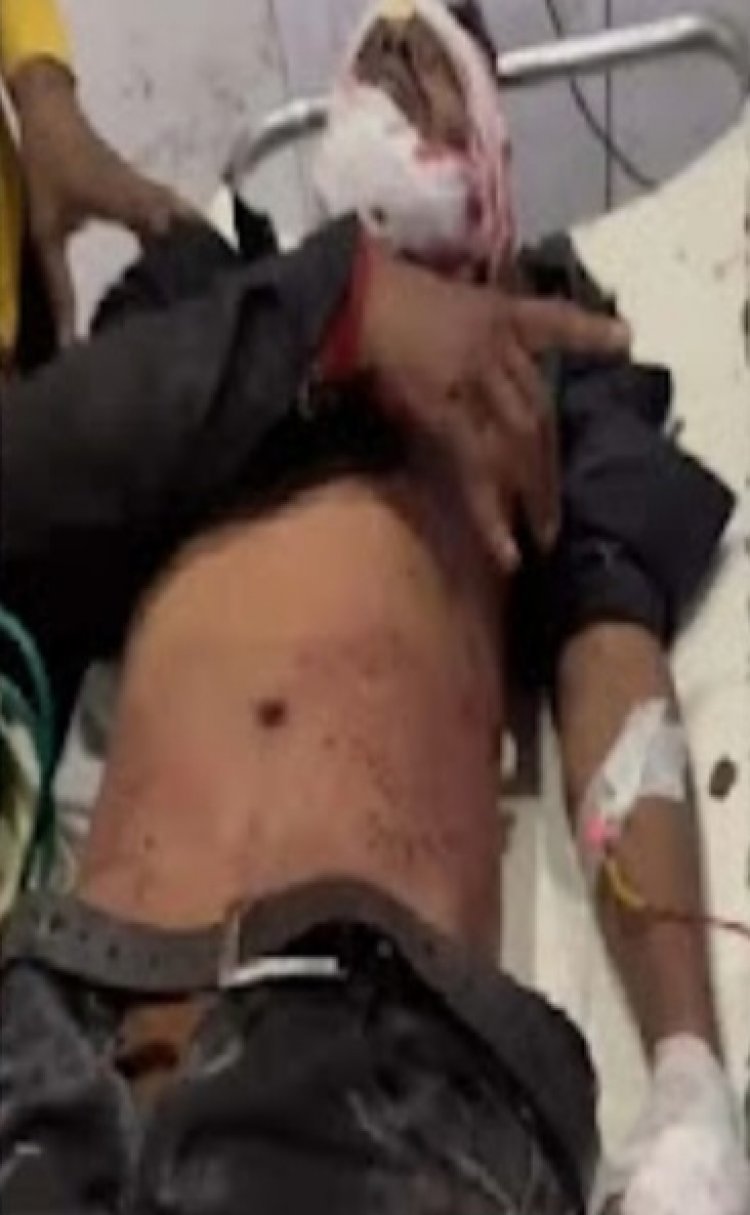 बीती रात खुर्सीपार में एक छोटे से विवाद ने हिंसक रूप लिया,तलवार और कटर से हमला, चार घायल, एक की हालत गंभीर
