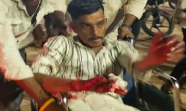 भिलाई में शराब के नशे में हुए झगड़े में एक दोस्त ने अपने ही साथी पर कटर से हमला कर घायल किया, युवक के प्राइवेट पार्ट और उंगली पर आई गंभीर चोटें