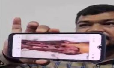 अस्पताल प्रबंधन की लापरवाही से गई मरीज़ की जान, परिजनों ने जताया आक्रोश