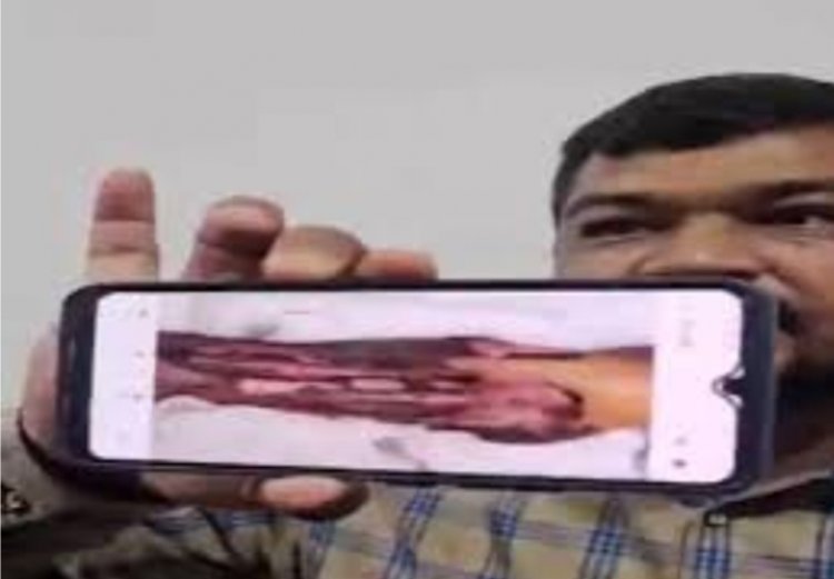 अस्पताल प्रबंधन की लापरवाही से गई मरीज़ की जान, परिजनों ने जताया आक्रोश