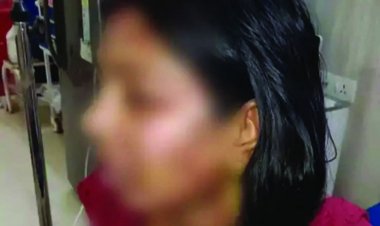 छत्तीसगढ़ के रायगढ़ में 250 रुपए के लिए पत्नी के ऊपर पति ने फेंका खौलता हुआ गर्म दाल