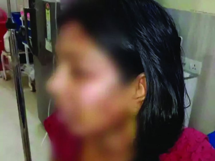 छत्तीसगढ़ के रायगढ़ में 250 रुपए के लिए पत्नी के ऊपर पति ने फेंका खौलता हुआ गर्म दाल