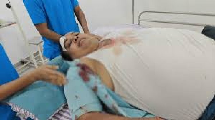डॉक्टर को समझाइश देना पड़ा महंगा: आपत्तिजनक स्थिति में टोकने पर प्रेमी युगल ने की मारपीट