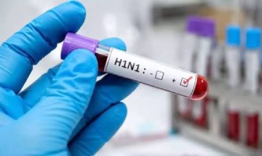 स्वाइन फ्लू के बढ़ते मामलों के बीच अलर्ट, जानें H1N1 और कोविड में अंतर व बचाव के जरूरी उपाय