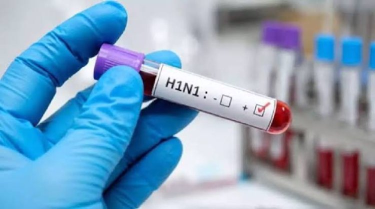 स्वाइन फ्लू के बढ़ते मामलों के बीच अलर्ट, जानें H1N1 और कोविड में अंतर व बचाव के जरूरी उपाय