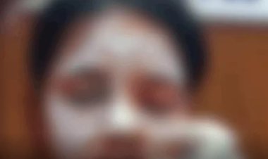 “कॉलेज जाने निकली युवती पर अज्ञात युवक ने फेंका एसिड, हमले के बाद तांदुला बांध के जंगल की ओर भागा”