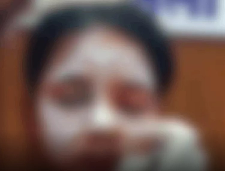 “कॉलेज जाने निकली युवती पर अज्ञात युवक ने फेंका एसिड, हमले के बाद तांदुला बांध के जंगल की ओर भागा”